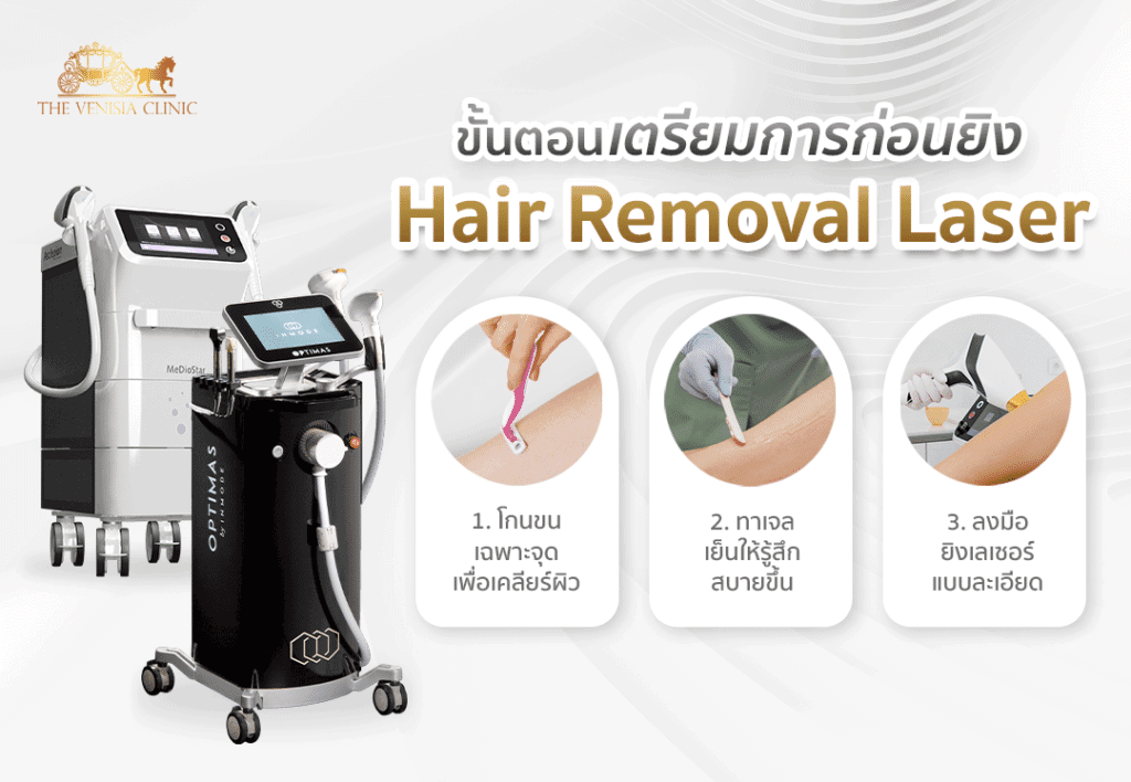 ขั้นตอนการยิง laser hair