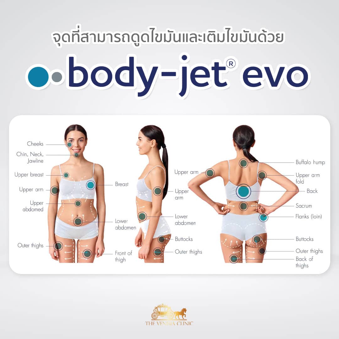 จุดที่ดูดไขมันด้วย body jet ได้