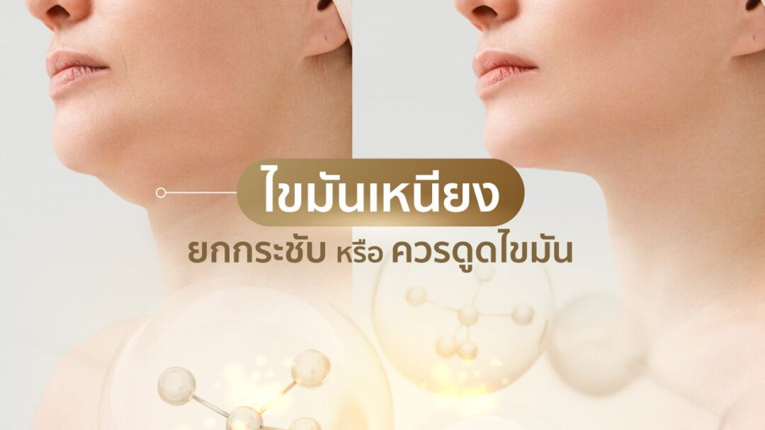 The-venisia-ไขมันเหนียง