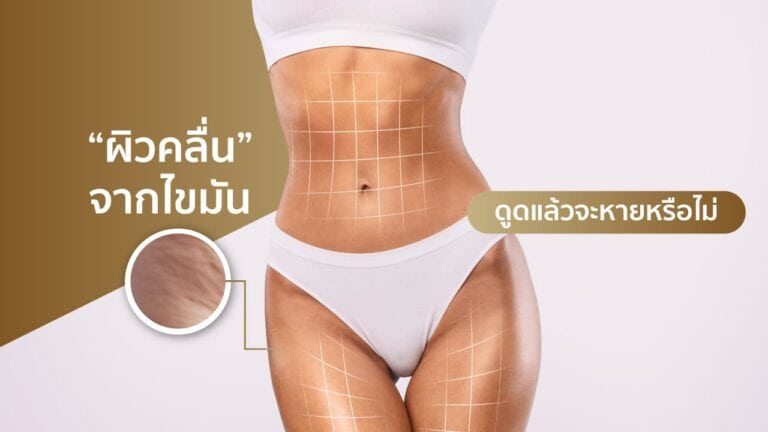 ผิวคลื่นจากไขมัน